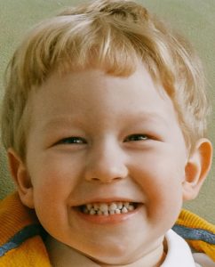 A photo showing a child's face cropped closely.